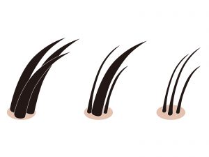 【プロが教える】育毛、ＡＧＡ（ＦＡＧＡ）、薄毛アフィリエイトでガッツリ稼ぐやり方！